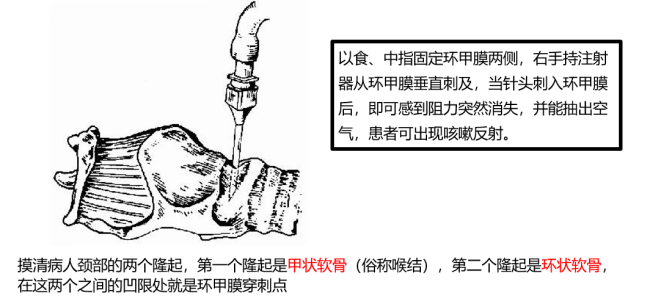 用环甲膜穿刺急救有哪些禁忌适应哪些情况