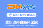 公开宣布：重庆白癜风医院哪家医院好-早期白癜风可以诊断吗