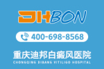 本周聚焦：重庆哪家医院白癜风靠谱“公开揭晓”胳膊腕上的白斑要注意什么