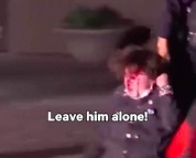 21岁大学生被联邦特工击中面部，致左眼失明、颅骨骨折