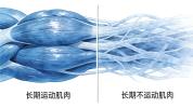 长期不运动的人不要突然开始 避免“一身伤”