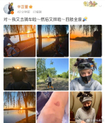 辛芷蕾骑车又摔了四肢全费 爱心伤疤引发热议