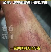 中国男子举报澳洲肉厂安全问题被辞 涉嫌报复性解雇