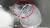 电动自行车加装雨篷遮阳伞非常危险 网友：出门都提心吊胆