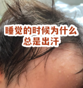 人为什么睡觉时更容易出汗？