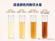 年轻人流行喝大水 医生提醒警惕水中毒 适量饮水才健康