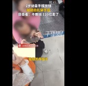 云南2岁幼童玩商场扶梯，被梳齿扎穿手指，目击者：当时家长在付款，孩子自己跑去电梯玩，后续被120救走了