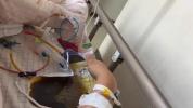 女子每天吃1个包子瘦9斤 结果被送医 盲目节食引发重症