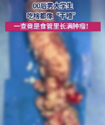 21岁大学生食管被肿瘤塞满致吞咽困难，医生微创“保胃”