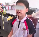 小孩哥牙龈发痒用尺子当痒痒挠被卡 消防员仅1分钟就完成"拔牙手术"