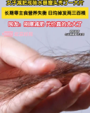 醫(yī)生提醒：極端戒碳水減肥致脫發(fā)健康風(fēng)險(xiǎn)需警惕