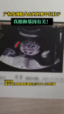 产检发现胎儿在妈妈腹中拉肚子 罕见基因缺陷所致