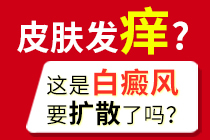 关注焦点：西安好的白癜风医院挂号“排名前五”-白癜风扩散和免疫力有什么关系?