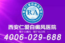 重点研究！西安看白癜风哪个医院*好"病因探索"黏膜型白癜风是怎么引起的