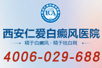 健康注意！西安哪的白癜风医院正规"用药*"激素治疗白癜风有什么不良反应