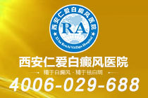 热点公开！西安治白癜风专业的医院"实力榜单"白癜风患者休息不好会怎样