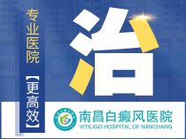 南昌治白癜风医院在哪里-紧急关注!南昌白癜风专病专治医院名单正式发布