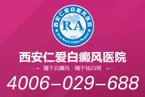 排名更新!西安治疗白癜风专业的医院"具体排行"白癜风反复发作是怎么回事