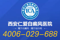 TOP排行!西安看白癜风的专科医院"前列名单"白癜风常见的六大问题