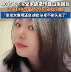 女子因家族遺傳從15歲就滿頭白發(fā) 與白發(fā)和解的美麗轉(zhuǎn)變