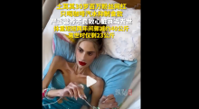 土耳其百萬(wàn)粉絲網(wǎng)紅因營(yíng)養(yǎng)不良去世 厭食癥奪命