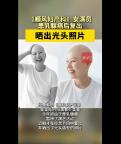 女演员患乳腺癌晒出光头照片 乐观面对生活