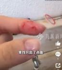 女子被加州王蛇咬住淡定沖水 八年寵物蛇無毒