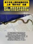 男子上廁所被毒蛇咬傷淡定拍照自救 冷靜應對轉危為安