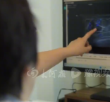 女子6毫米结节确诊乳腺癌，医生提醒：乳腺微小结节隐蔽性强，很容易被忽略