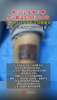 连贴三晚,膝盖深Ⅲ度烫伤!很多人冬天都在用