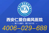 实时更新：西安市白癜风医院“前五公开”-女生白癜风患者治疗需关注哪些重点？