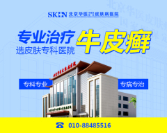 北京牛皮癣哪里看的好-牛皮癣早期三个征兆