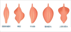 排行公开：重庆靠谱的阴唇整形手术医院榜单前十-重庆军科整形美容医院私密整形中心榜上有名！