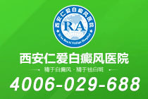 即时视点：商洛专业白癜风医院“环境优雅”-白癜风会随年龄增长逐渐扩散吗？