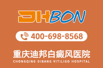 重庆白癜风哪个医院好-重庆治疗白斑医院排名前五
