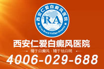 本周榜单！西安白癜风去哪家医院治疗"名单出炉"白癜风为什么反复发作