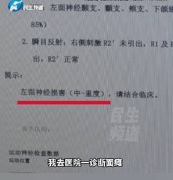 郑州一青年暴怒后，突然嘴歪、眼滑。面瘫患者