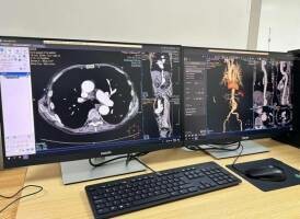 济南市莱芜区新服务上线:上腹增强CT,守护居民健康