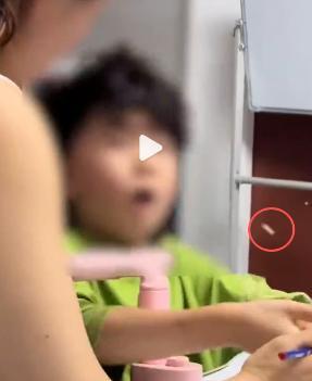 妈妈辅导作业一巴掌撞掉孩子门牙 情绪失控背后的教育压力