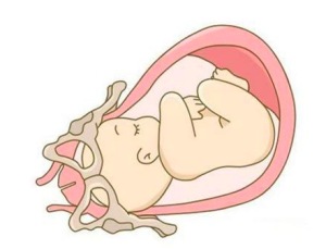 胎儿什么时候入盆 胎儿入盆什么时候会生