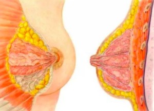 预防乳腺癌饮食该注意哪些？ 细数乳腺癌喜欢转移的部位