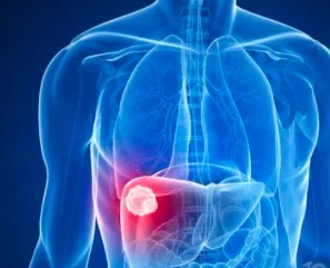 肝癌术后抗复发的治疗手段有哪些 肝癌的治疗方法有哪些