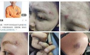 山东泰山球员成源酒后殴打他人 被拘留10日