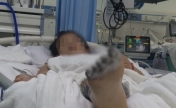 女生玩手机被电击受伤 内脏受损，面临截肢