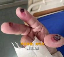 一次意外接触就不幸身亡 警惕身边这些化学品