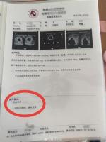 辽宁一孕妇两个月从一胎变四胞胎 罕见同卵四胞胎引发关注