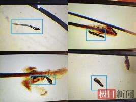 女子每天化精致眼妆睫毛藏6条螨虫 美丽背后的隐患