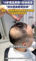 男生熬夜一年几乎秃顶 健康敲响警钟