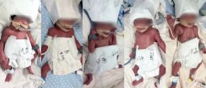 新疆产妇在武汉诞下五胞胎 罕见奇迹温暖人心