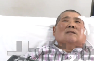 1天刷1次牙致颌面部间隙感染：主要集中在40岁以上的中老年人